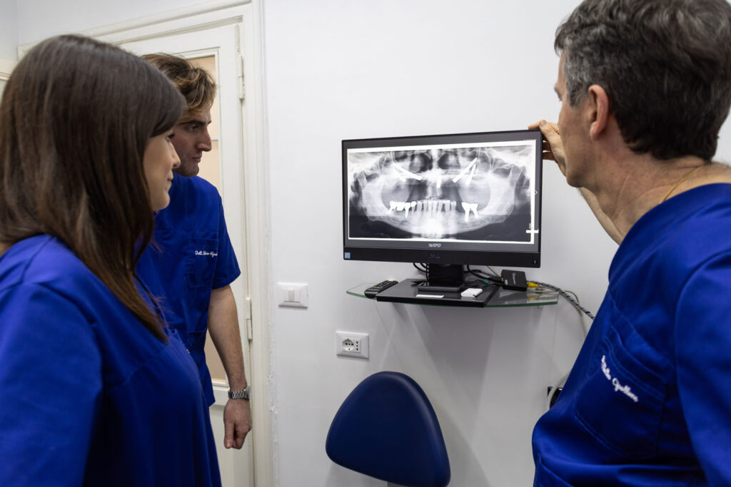 Valutazione dentista con la sua equipe sulla gestione di un terzo molare incluso guardando una radiografia