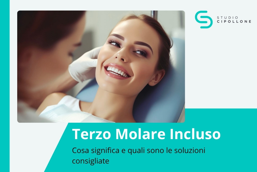 terzo molare incluso copertina del blog