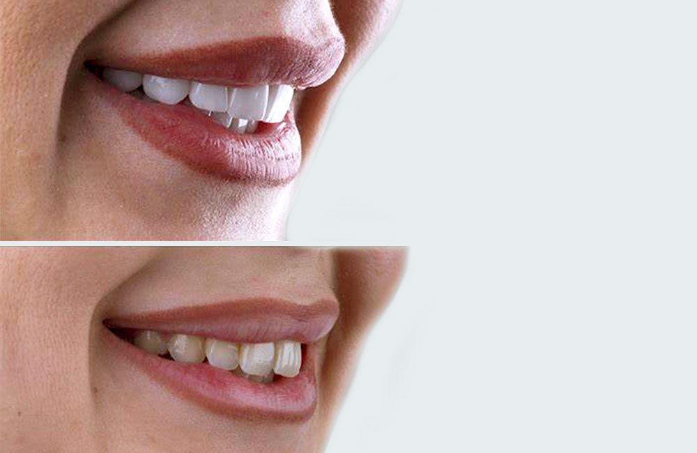 estetica denti