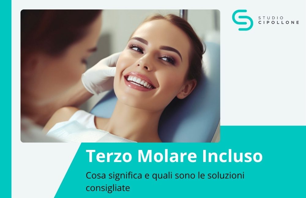 terzo molare incluso copertina del blog